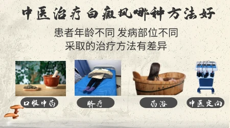 口服中药调理对白癜风有没有用