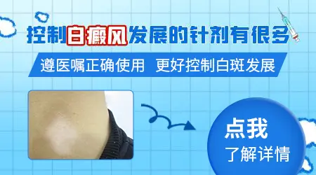 白癜风初期打针能控制住不扩散吗