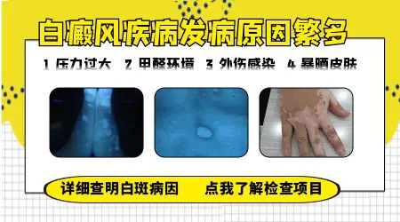 脸上白癜风初期症状图片