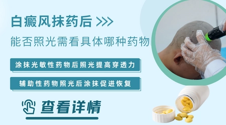 白癜风照光前能不能先涂外用药增强效果
