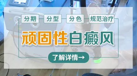 多年白癜风有恢复的可能吗