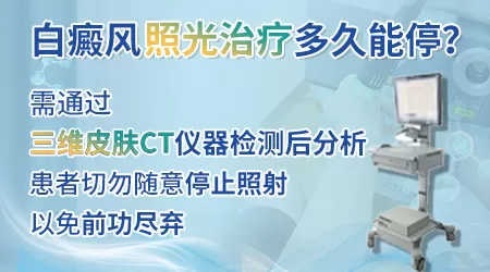 紫外线光疗仪长照射几分钟