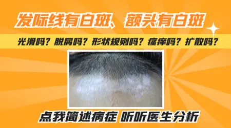 额头发际线边缘皮肤很白是什么情况