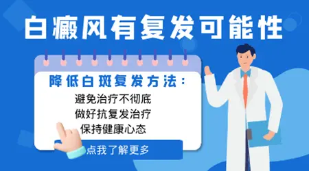 白癜风种植后会复发吗
