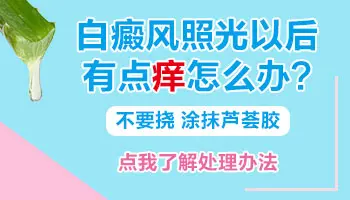 311光疗后白斑皮肤很痒