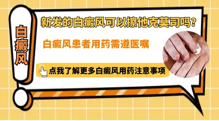 他克莫司治疗隐形白斑吗