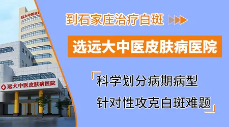 石家庄有没有治疗白癜风的中西医结合医院