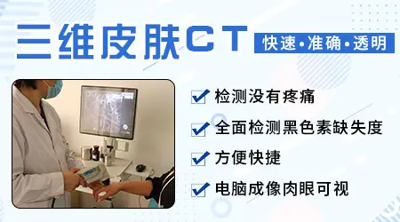 伍德灯检查能看出白斑的严重程度吗
