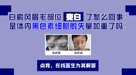 男孩眉毛中间白了一片