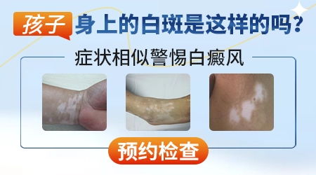 儿童腋窝皮肤有一块地方比较白