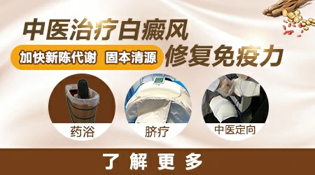 白癜风能根治好吗