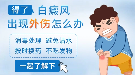白癜风外伤会导致新发白斑吗