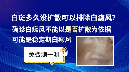 宝宝身上有一块白斑没扩散是白癜风吗