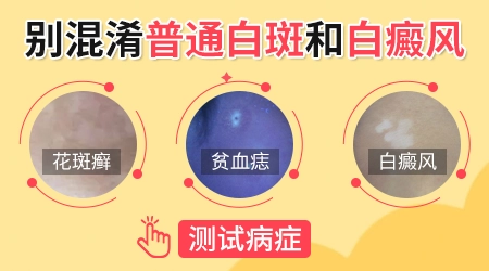 胳膊上突然白了好几块是怎么回事