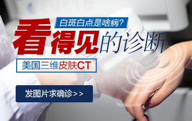 石家庄医院做皮肤ct多少钱做一次