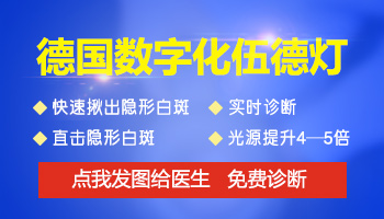 wood灯可见瓷白色荧光是白癜风吗