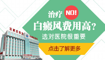 做白癜风的检查大概需要多少钱