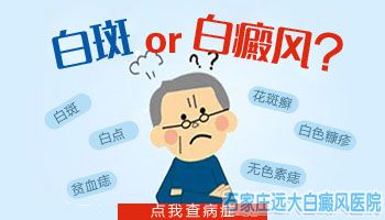腰两侧长白斑是什么原因