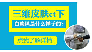 婴儿身上的白斑能用伍德灯确诊吗