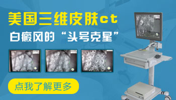 伍德灯检查白斑有荧光好还是无荧光好