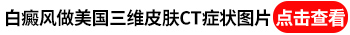 小腹和胸部都有一些白点做ct能查出是什么吗