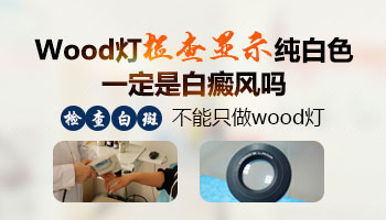 手指小白点做wood灯检查大概要多少钱