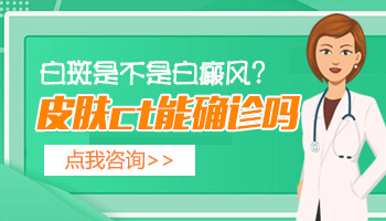 wood灯检查白斑未见明显荧光是白癜风吗