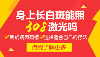 手关节长白斑可以照308激光吗