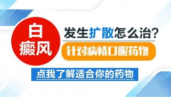 手部白癜风扩散了怎么治疗