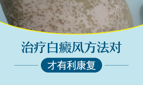 秋天治疗白癜风做植皮手术怎么样