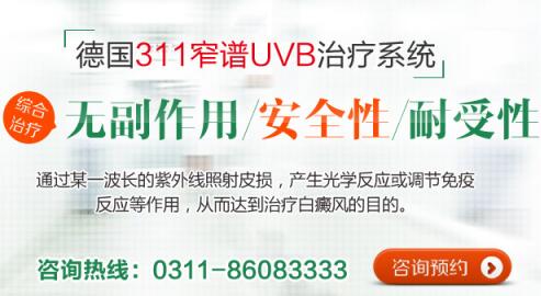 uvb治白癜风打一次多长时间好