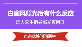 白癜风照308激光恢复过程有什么变化