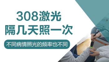 高中生长白癜风多久照一次308激光