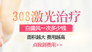 308激光照白斑一次多少钱
