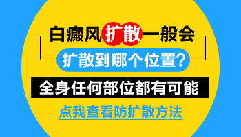 脸上的白斑发展挺快身上也有很多白点怎么办