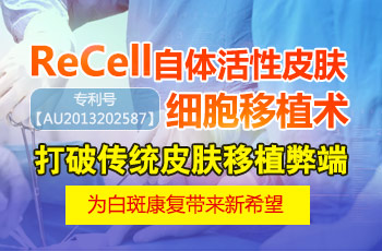 recell技术是2019治疗白癜风的新方法吗