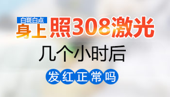 白癜风做了308激光要红几天