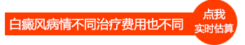 白癜风专科医院照激光是如何收费的