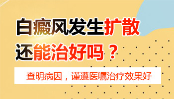 308激光能控制住白癜风不扩散吗