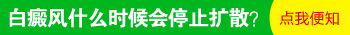 308激光能控制住白癜风不扩散吗