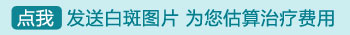 308激光照白癜风一回多少钱