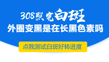 白癜风患者涂他克莫司脸上有效果关节上为什么没效果