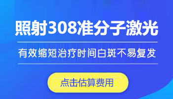 白癜风308准分子激光能不能天天照